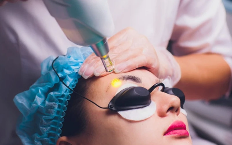 Ưu điểm vượt trội của phương pháp xóa xăm chân mày, mí, môi bằng laser (Nguồn: Internet)