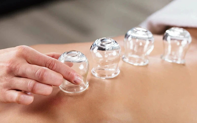 Precautions for the abdominal cupping (Source: Internet).