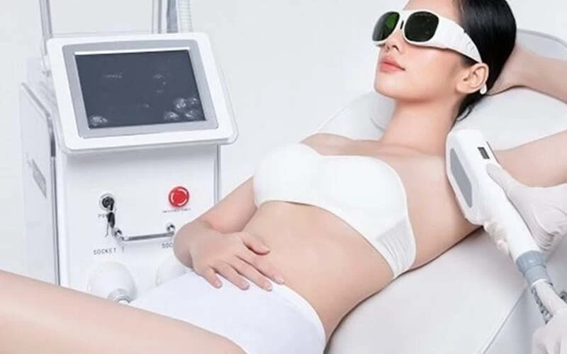 Top advanced hair removal technologies today (Source: Internet)
