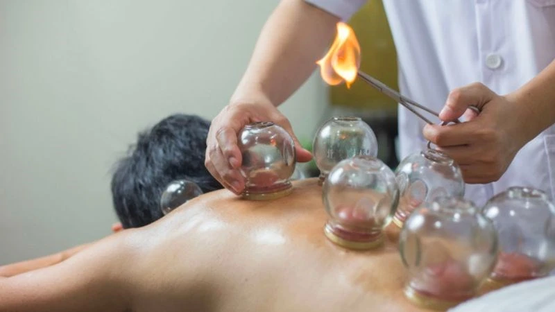 The back cupping therapy procedure (Source: Internet).