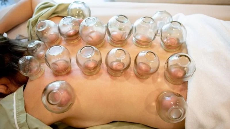 Is back cupping therapy dangerous? (Source: Internet).