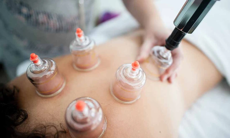 Relax with back cupping therapy at NP SPA (Source: NP SPA).