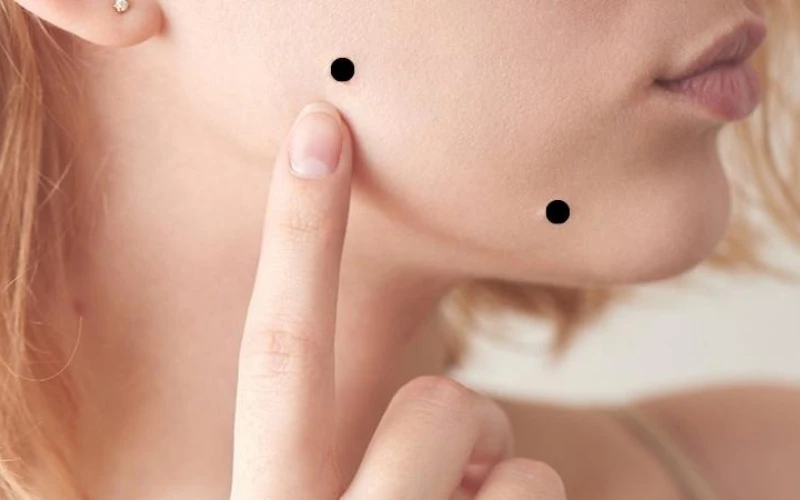 What is feng shui mole enhancement? (Source: internet)