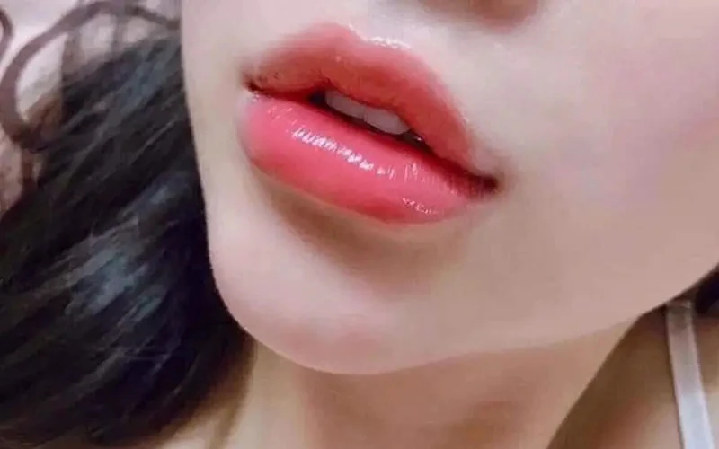 Results of heart-shaped lip contouring (Source: Internet)