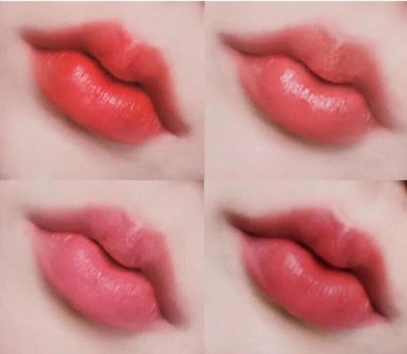 Aftercare for perfect heart-shaped lips (Source: Internet)