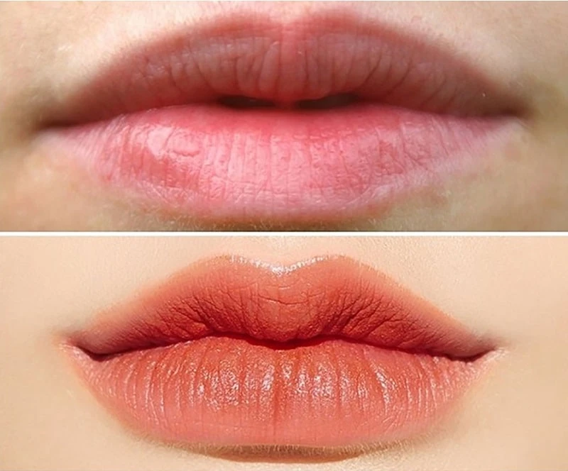 Before and after heart-shaped lip contouring (Source: Internet)