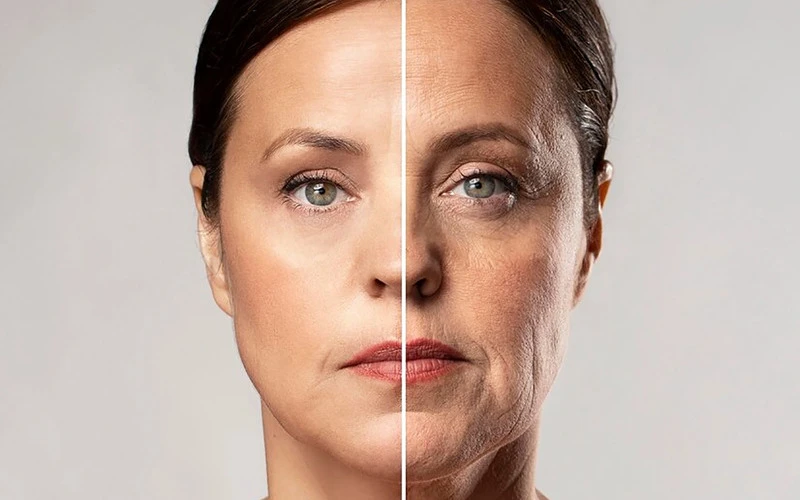 Candidates for hydrating and Rejuvenating Skin Treatment (Source: Internet)