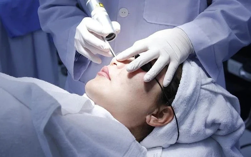 Laser treatment for acnes (Source: Internet)
