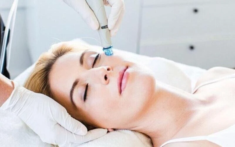 Benefits of laser treatment for acnes (Source: Internet)